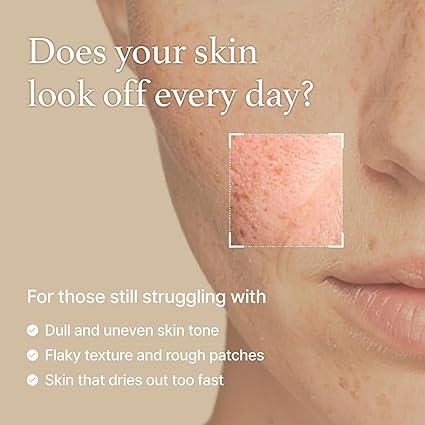 Rice Toner for Sensitive Skin 5.07